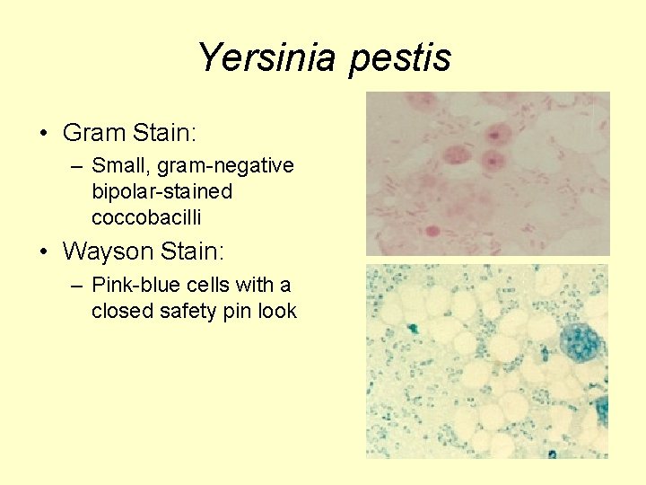 Yersinia pestis • Gram Stain: – Small, gram-negative bipolar-stained coccobacilli • Wayson Stain: –