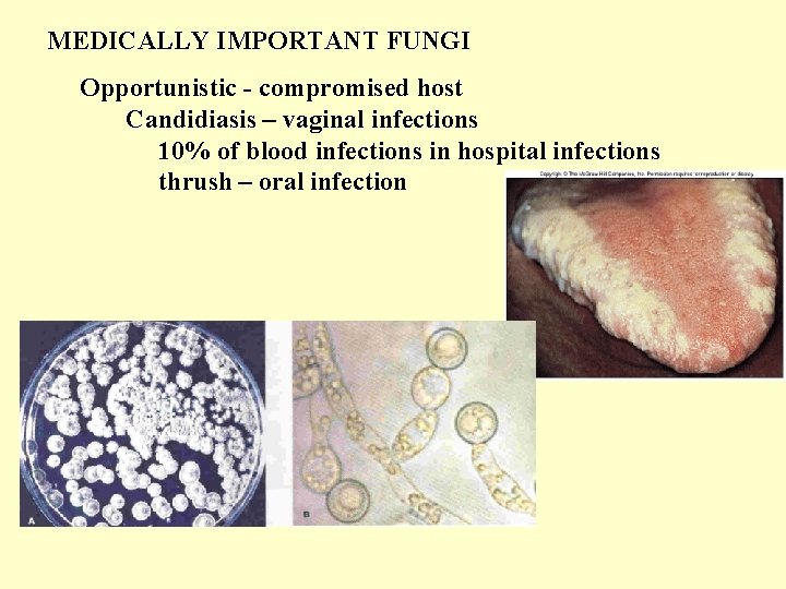 MEDICALLY IMPORTANT FUNGI Opportunistic - compromised host Candidiasis – vaginal infections 10% of blood