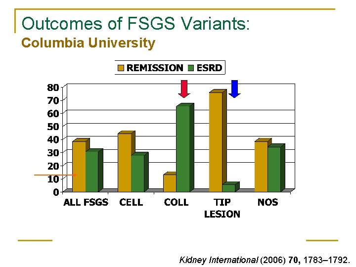 Outcomes of FSGS Variants: Columbia University Kidney International (2006) 70, 1783– 1792. Outcomes of FSGS Variants: Columbia University Kidney International (2006) 70, 1783– 1792.