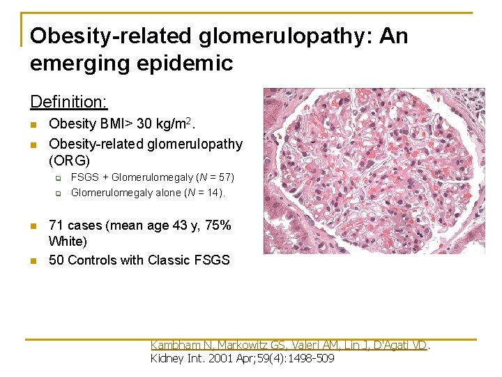 Obesity-related glomerulopathy: An emerging epidemic Definition: n n Obesity BMI> 30 kg/m 2. Obesity-related Obesity-related glomerulopathy: An emerging epidemic Definition: n n Obesity BMI> 30 kg/m 2. Obesity-related