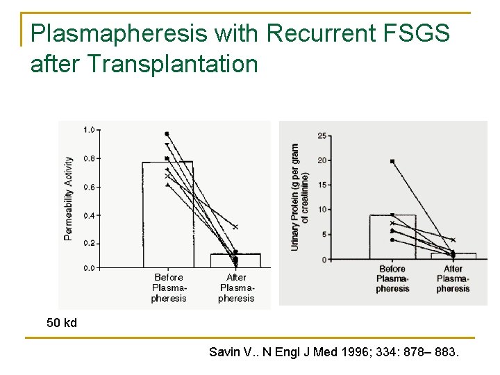Plasmapheresis with Recurrent FSGS after Transplantation 50 kd Savin V. . N Engl J Plasmapheresis with Recurrent FSGS after Transplantation 50 kd Savin V. . N Engl J