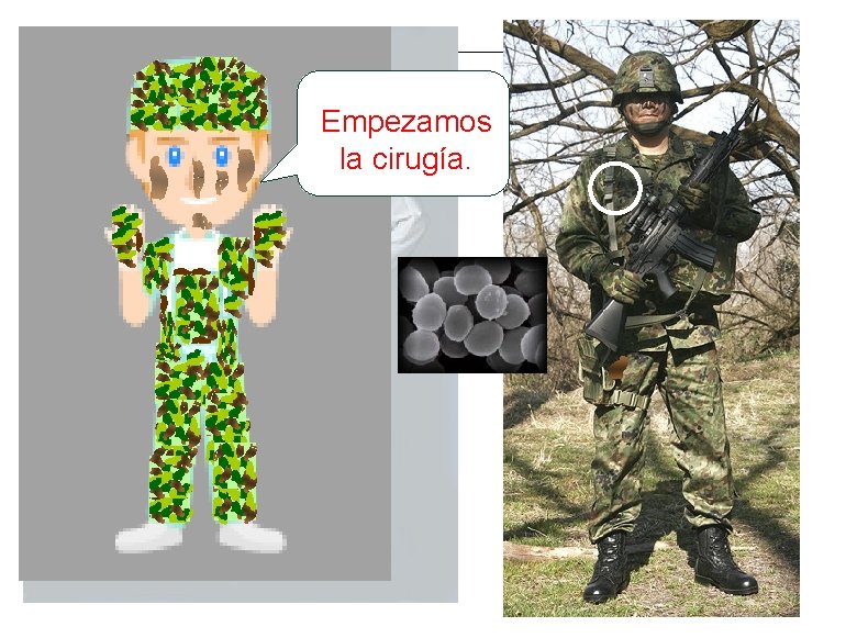Empezamos la cirugía. Empezamos la cirugía.