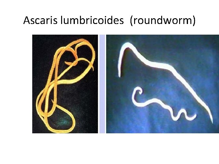 Ascaris lumbricoides (roundworm) 