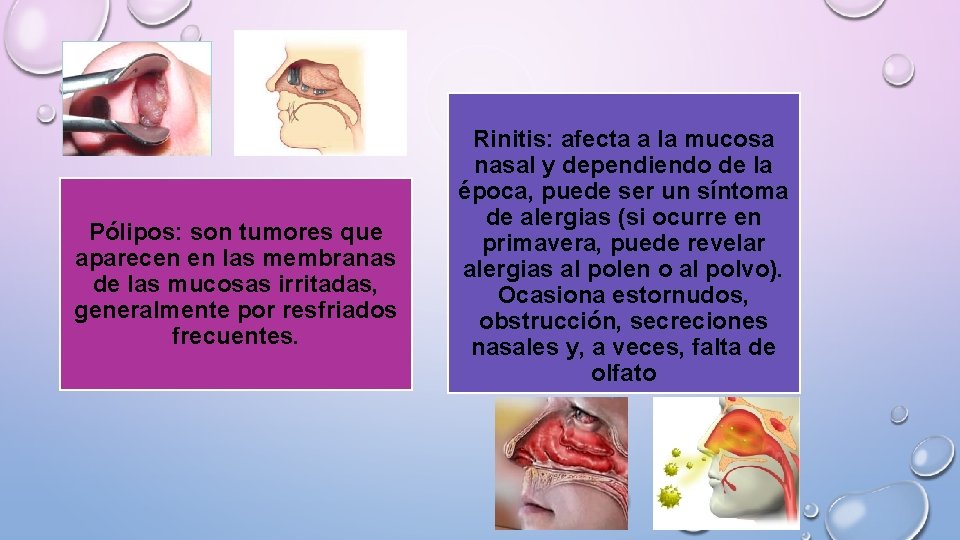 Pólipos: son tumores que aparecen en las membranas de las mucosas irritadas, generalmente por