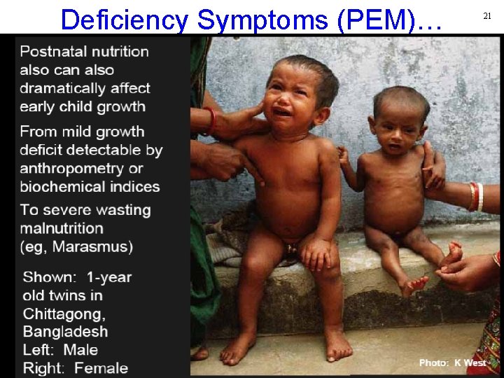 Deficiency Symptoms (PEM)… 21 