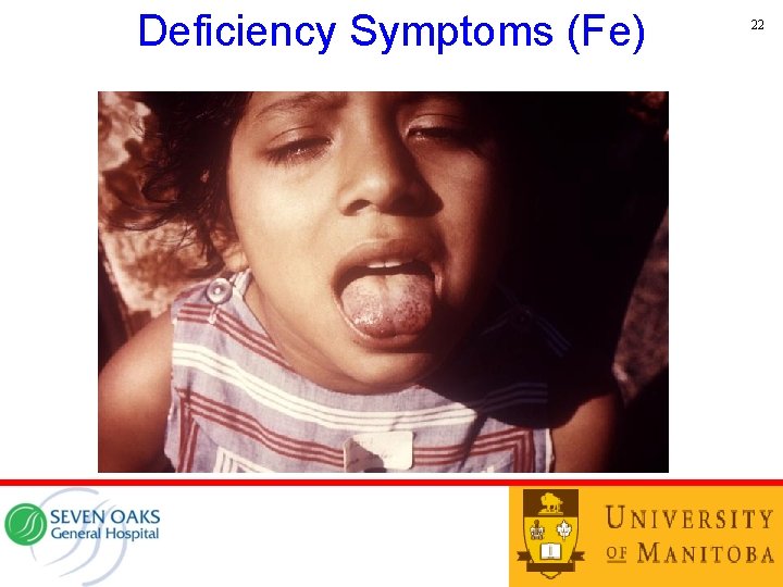 Deficiency Symptoms (Fe) 22 