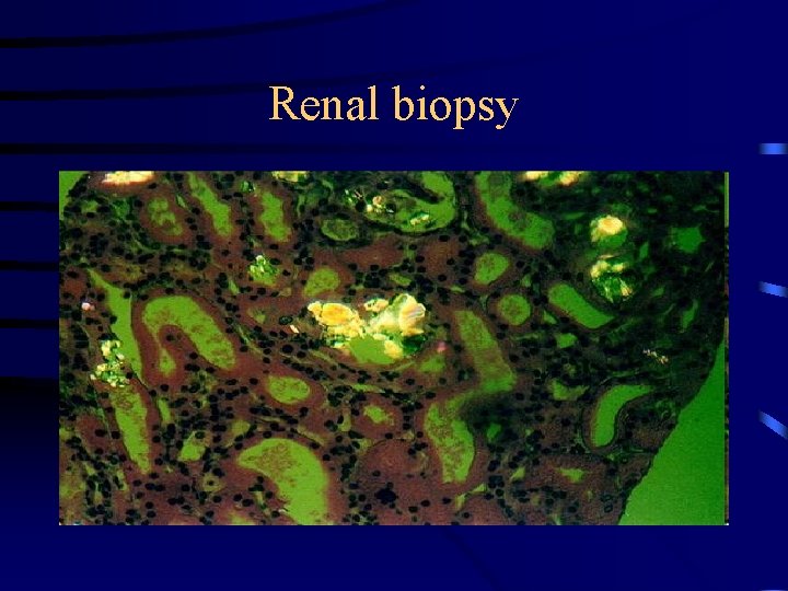 Renal biopsy 