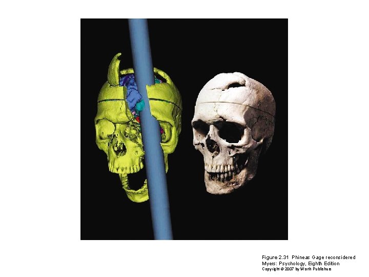Figure 2. 31 Phineas Gage reconsidered Myers: Psychology, Eighth Edition Copyright © 2007 by