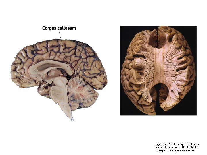 Figure 2. 35 The corpus callosum Myers: Psychology, Eighth Edition Copyright © 2007 by