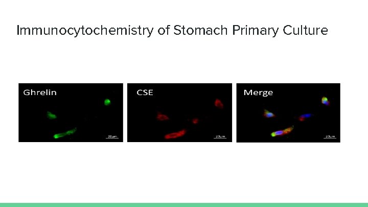 Immunocytochemistry of Stomach Primary Culture 