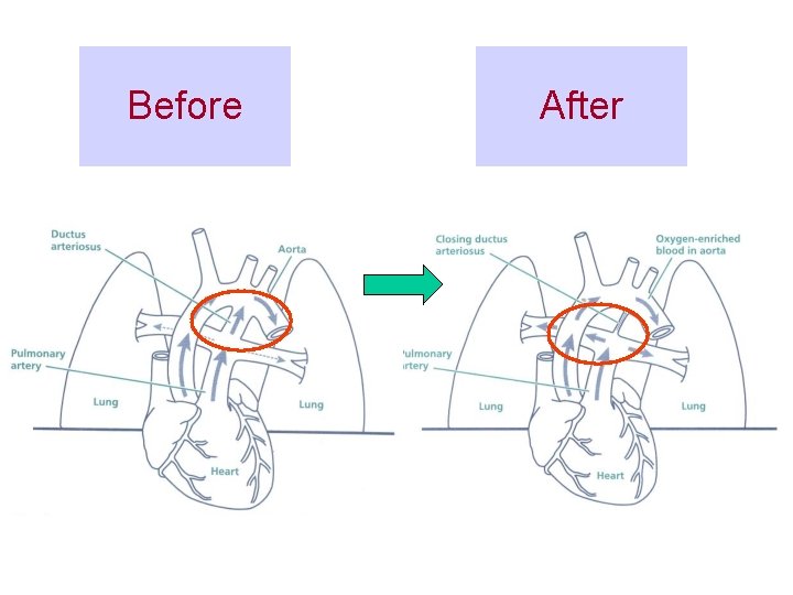 Before After 