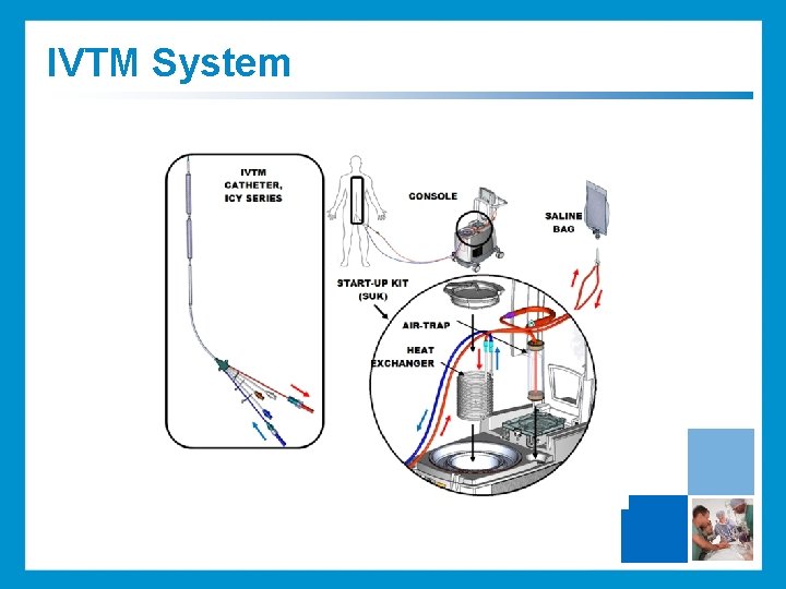 IVTM System 