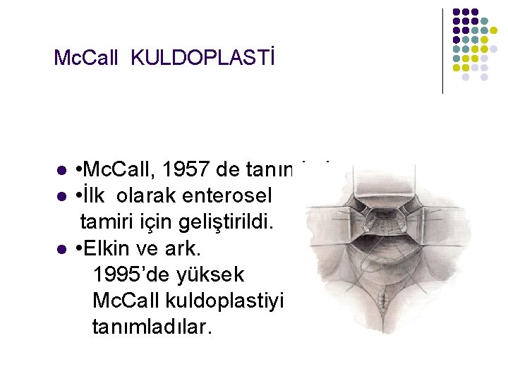 Mc. Call KULDOPLASTİ • Mc. Call, 1957 de tanımladı. l • İlk olarak enterosel