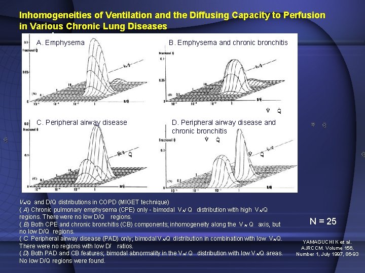 Inhomogeneities of Ventilation and the Diffusing Capacity to Perfusion in Various Chronic Lung Diseases Inhomogeneities of Ventilation and the Diffusing Capacity to Perfusion in Various Chronic Lung Diseases