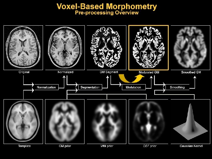 VBM Voxelbased morphometry Nicola Hobbs Marianne Novak Thanks