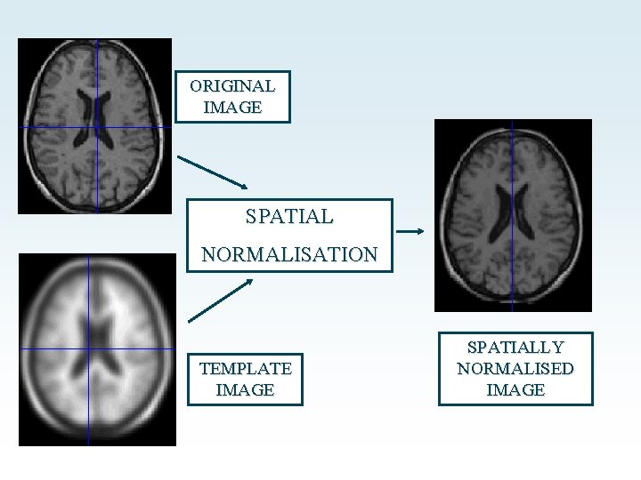 VBM Voxelbased morphometry Nicola Hobbs Marianne Novak Thanks