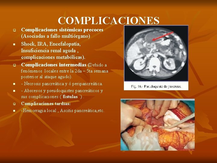 COMPLICACIONES q n n q n Complicaciones sistémicas precoces (Asociadas a fallo multiórgano) Shock,