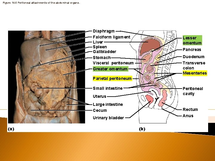 Figure 14. 5 Peritoneal attachments of the abdominal organs. Diaphragm Falciform ligament Liver Spleen