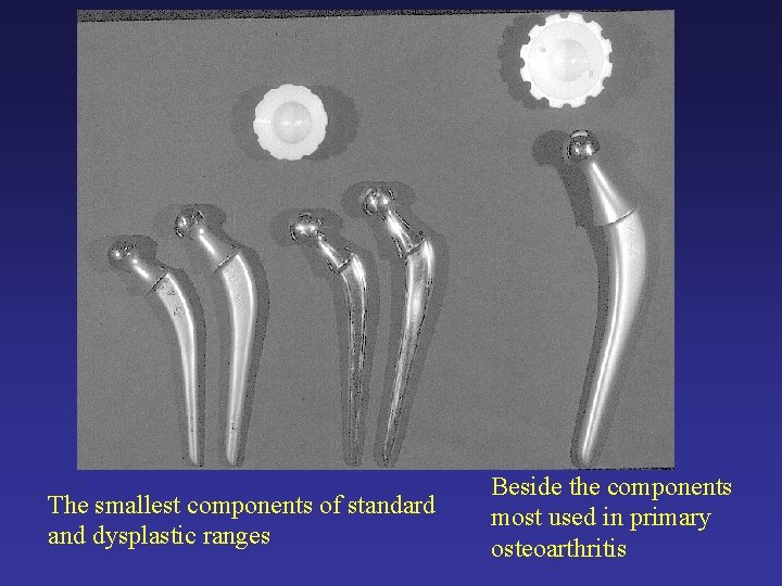 The smallest components of standard and dysplastic ranges Beside the components most used in The smallest components of standard and dysplastic ranges Beside the components most used in