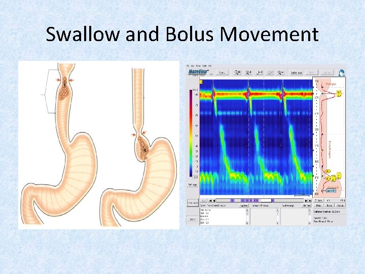 Swallow and Bolus Movement 