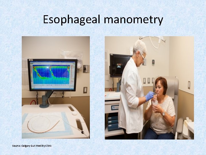 Esophageal manometry Source: Calgary Gut Motility Clinic 