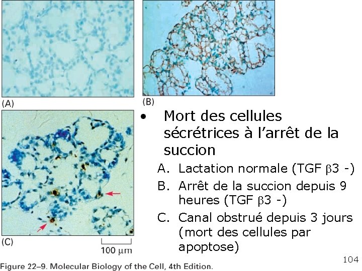 • fig. 22 -9 Mort des cellules sécrétrices à l’arrêt de la succion • fig. 22 -9 Mort des cellules sécrétrices à l’arrêt de la succion
