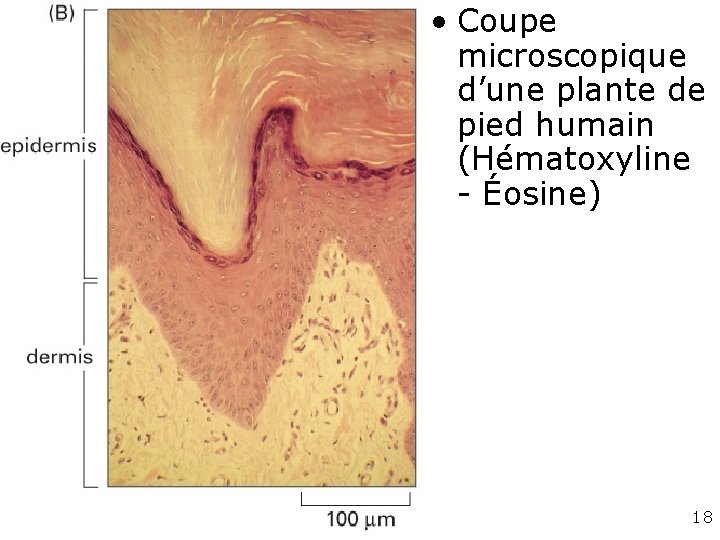 • Coupe microscopique d’une plante de pied humain (Hématoxyline - Éosine) Fig 22 • Coupe microscopique d’une plante de pied humain (Hématoxyline - Éosine) Fig 22