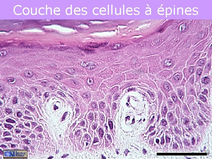 Couche des cellules à épines 33 Couche des cellules à épines 33