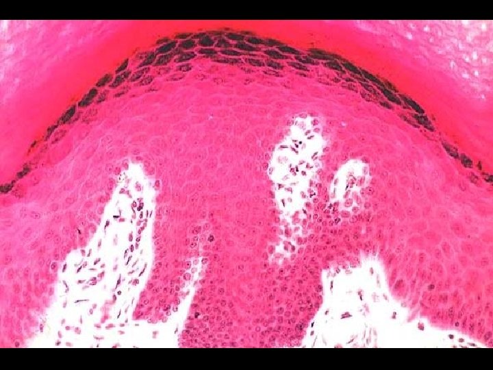 Couche des cellules granuleuses 41 Couche des cellules granuleuses 41