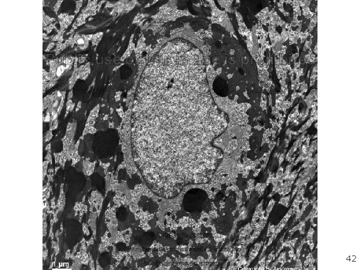 Cellule granuleuse 42 Cellule granuleuse 42