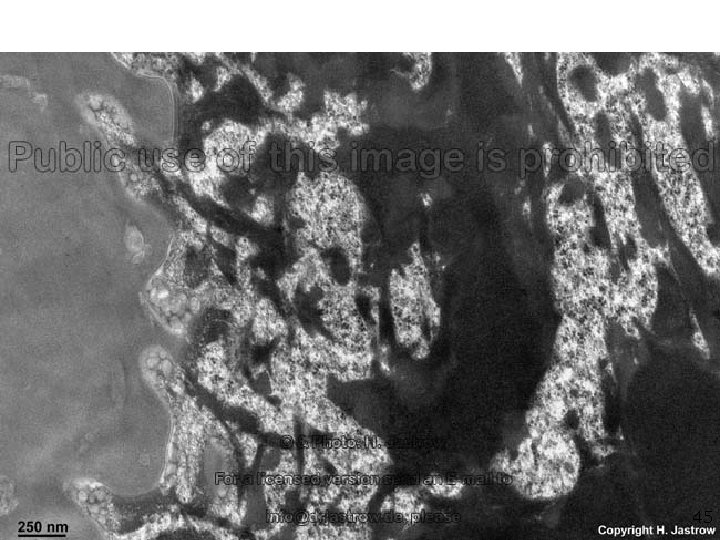 Cellule de la couche claire 45 Cellule de la couche claire 45