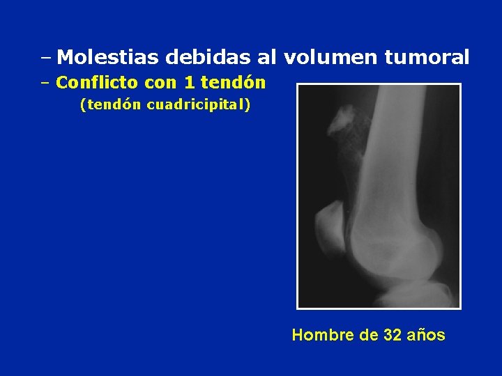 – Molestias debidas al volumen tumoral – Conflicto con 1 tendón (tendón cuadricipital) Hombre