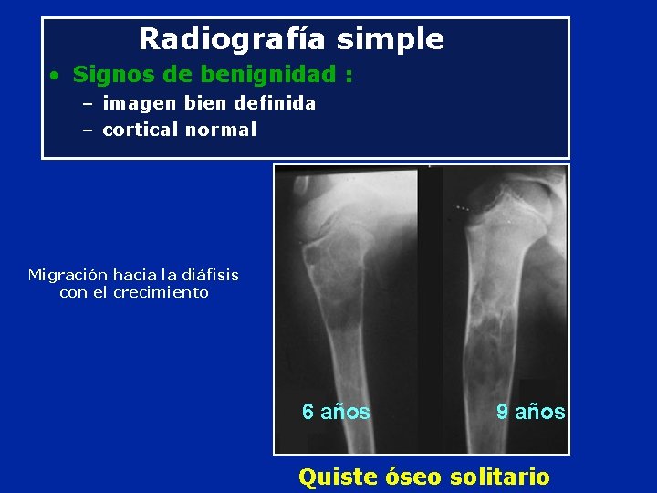 Radiografía simple • Signos de benignidad : – imagen bien definida – cortical normal