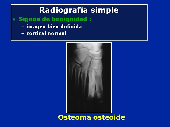 Radiografía simple • Signos de benignidad : – imagen bien definida – cortical normal