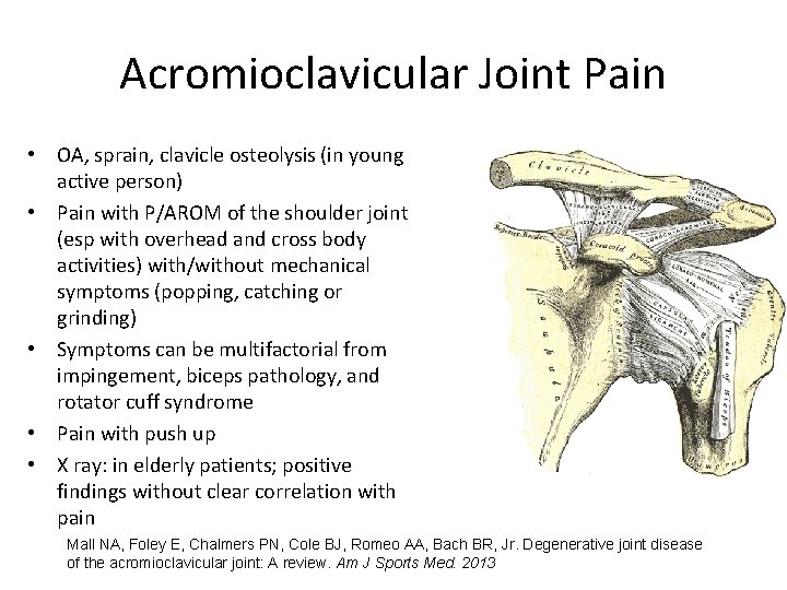 Acromioclavicular Joint Pain • OA, sprain, clavicle osteolysis (in young active person) • Pain