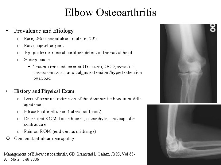 Elbow Osteoarthritis • Prevalence and Etiology o o • Rare, 2% of population, male,