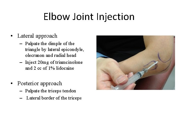 Elbow Joint Injection • Lateral approach – Palpate the dimple of the triangle by