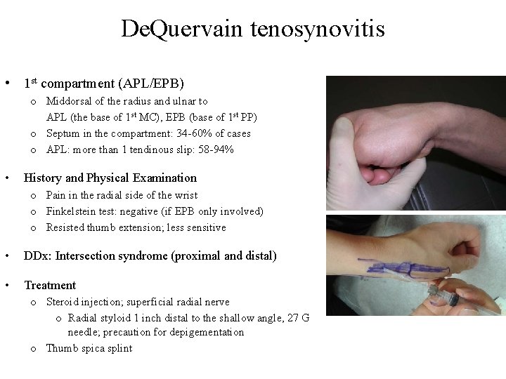 De. Quervain tenosynovitis • 1 st compartment (APL/EPB) o Middorsal of the radius and