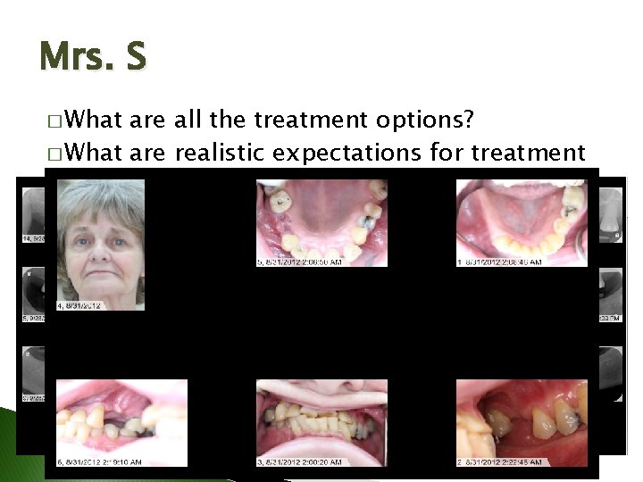 Mrs. S � What are all the treatment options? � What are realistic expectations Mrs. S � What are all the treatment options? � What are realistic expectations
