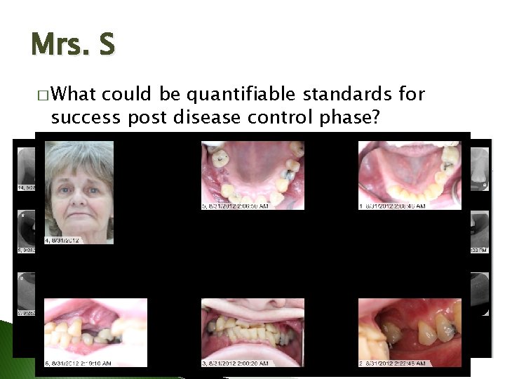 Mrs. S � What could be quantifiable standards for success post disease control phase? Mrs. S � What could be quantifiable standards for success post disease control phase?