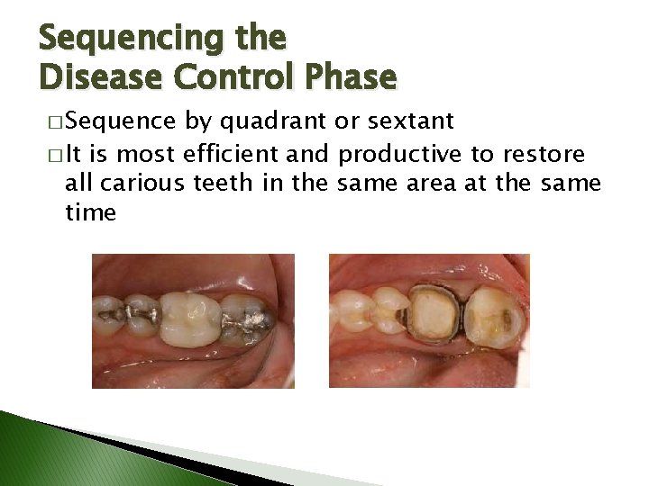 Sequencing the Disease Control Phase � Sequence by quadrant or sextant � It is Sequencing the Disease Control Phase � Sequence by quadrant or sextant � It is