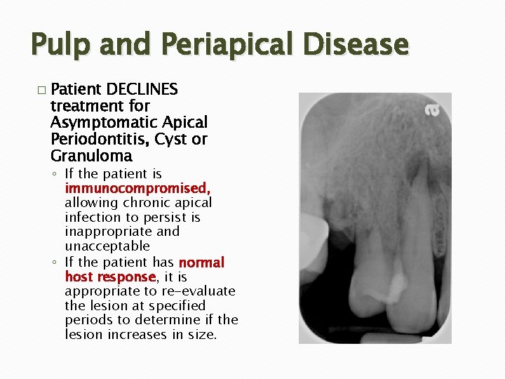 Pulp and Periapical Disease � Patient DECLINES treatment for Asymptomatic Apical Periodontitis, Cyst or Pulp and Periapical Disease � Patient DECLINES treatment for Asymptomatic Apical Periodontitis, Cyst or