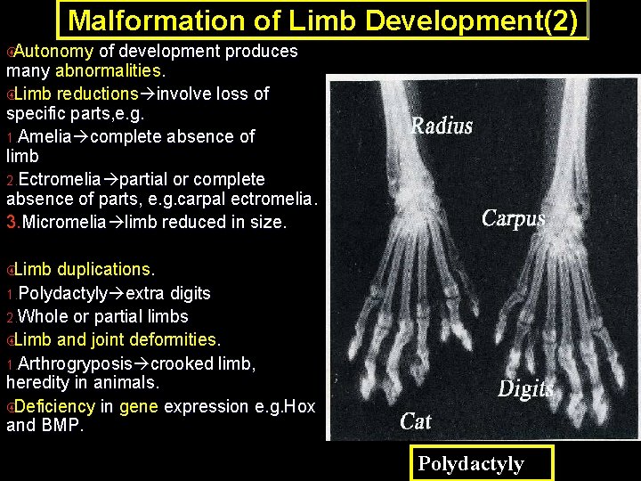 Malformation of Limb Development(2) Autonomy of development produces many abnormalities. Limb reductions involve loss