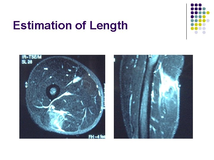 Estimation of Length 