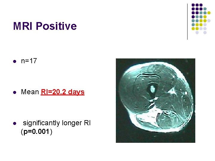 MRI Positive l n=17 l Mean RI=20. 2 days l significantly longer RI (p=0.
