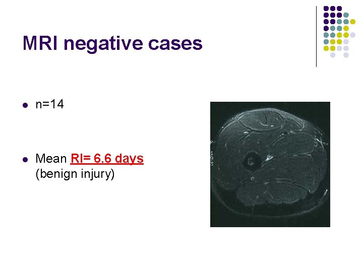 MRI negative cases l n=14 l Mean RI= 6. 6 days (benign injury) 