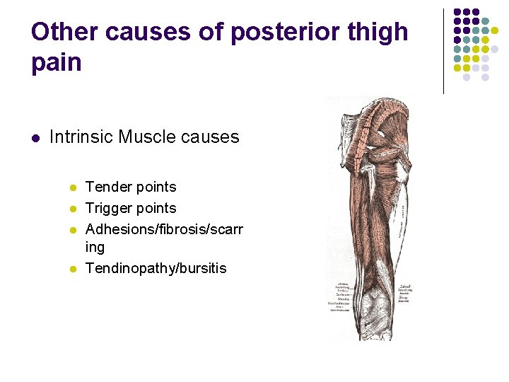 Other causes of posterior thigh pain l Intrinsic Muscle causes l l Tender points
