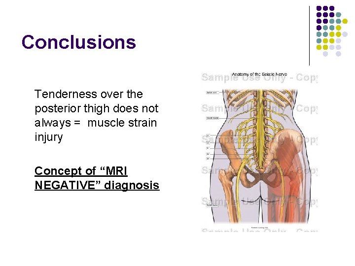 Conclusions Tenderness over the posterior thigh does not always = muscle strain injury Concept