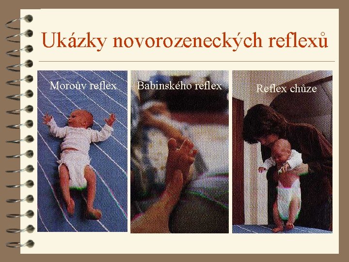 Ukázky novorozeneckých reflexů Moroův reflex Babinského reflex Reflex chůze 