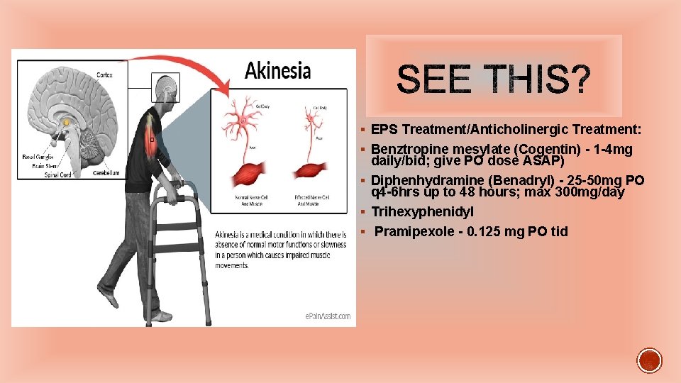 § EPS Treatment/Anticholinergic Treatment: § Benztropine mesylate (Cogentin) - 1 -4 mg daily/bid; give